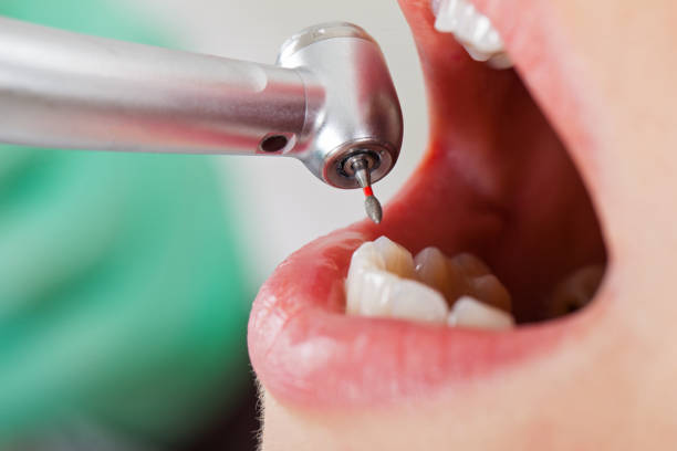 Best Emergency Broken Tooth Repair in Durand, WI